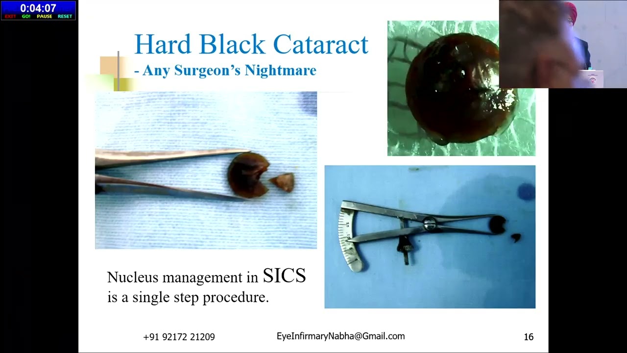 AIOCMT3 2024   GP8 topic   Dr DHALIWAL RANJIT SINGH Manual SICS   Surgery for all seasons and reason