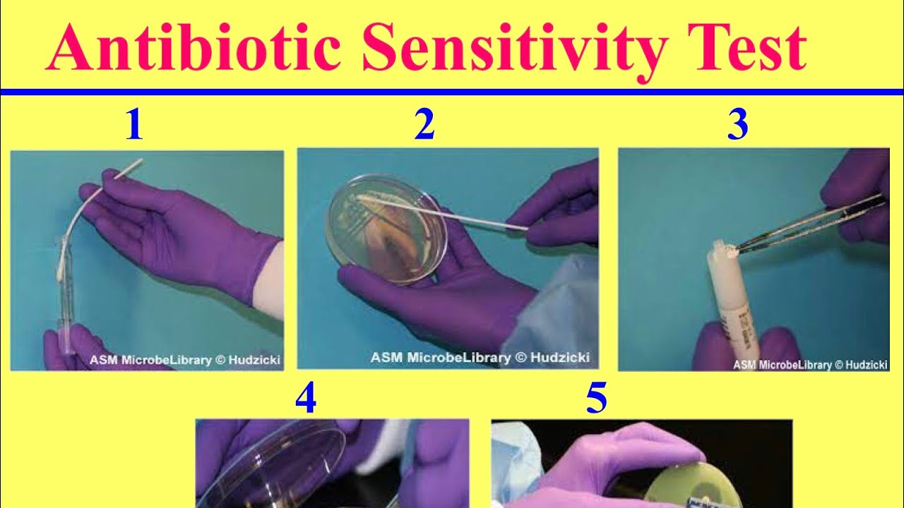 إختبار الحساسية للمضادات الحيوية لمزارع الدواجن Antibiotic Sensitivity Test for Poultry Farms