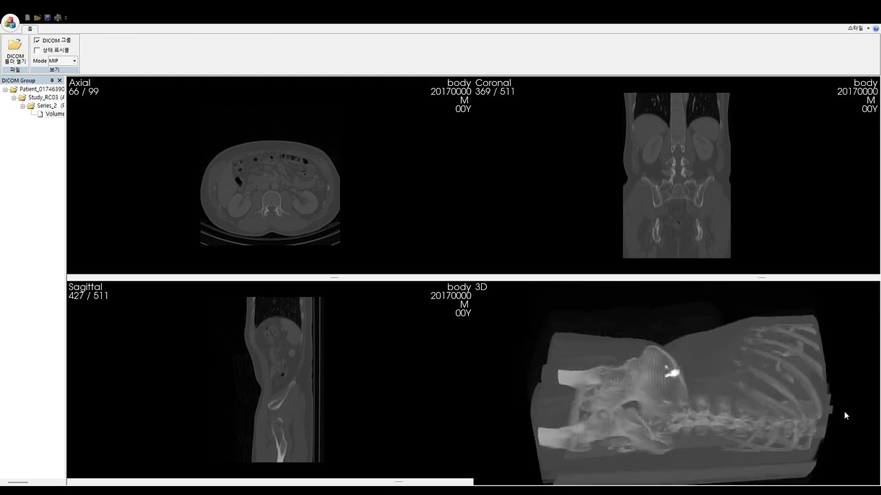 DICOM Viewer (VTK 9.4 & GDCM 3.0)