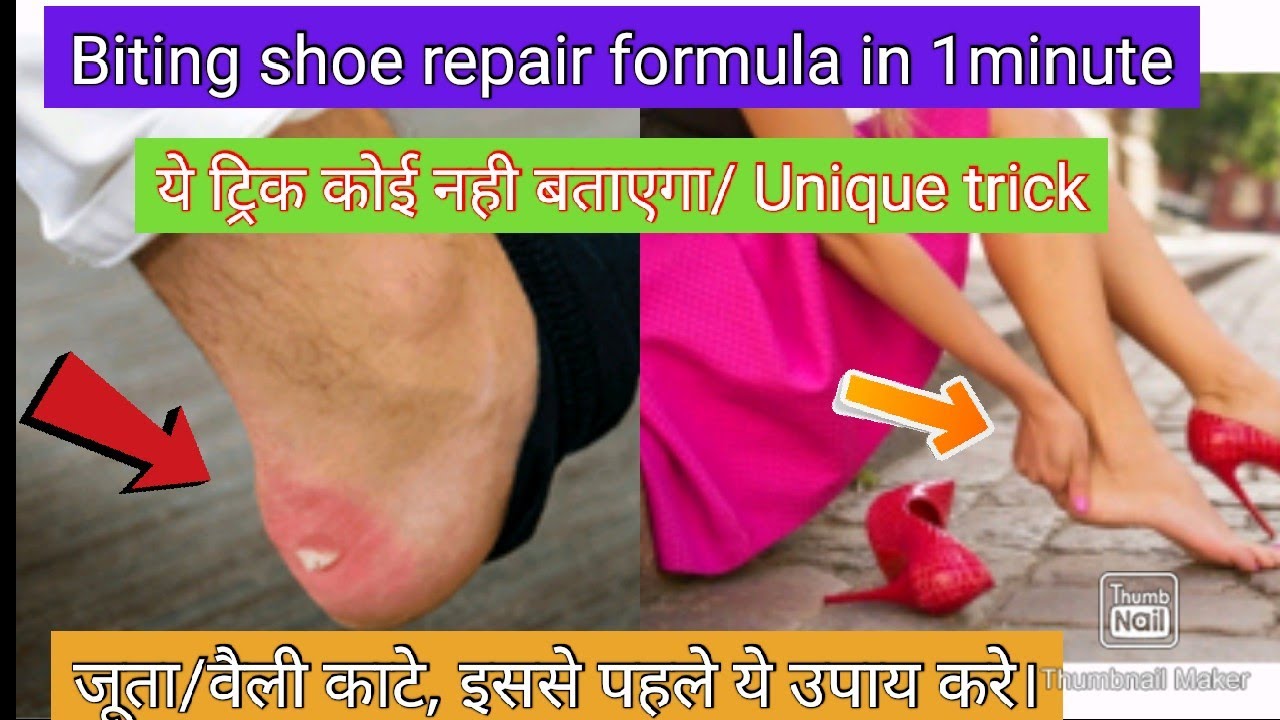 पैर काटने वाले जूते, वैली  को कैसे ठीक करें/kaatne wale joote ko kaise theek kare/Shoe bite solution