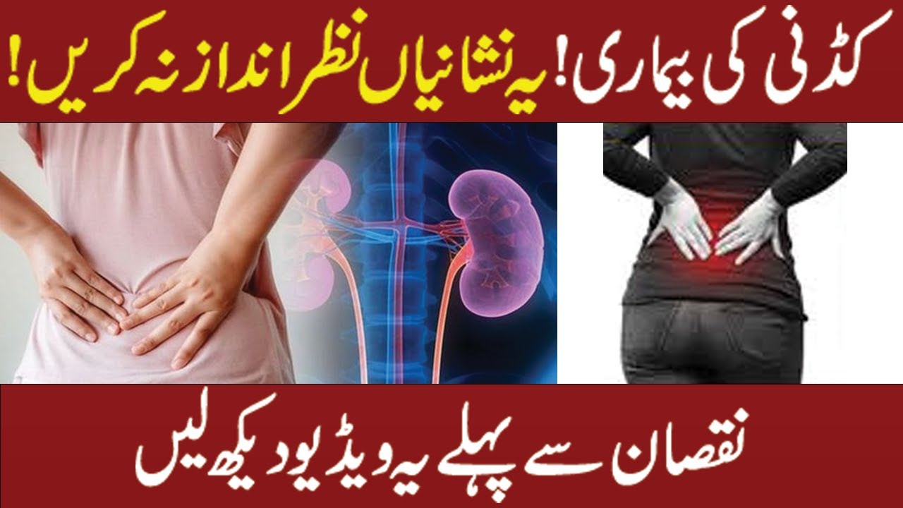 @Ta'aseen Homeopathic Clinic کڈنی کی بیماری !یہ نشانیاں نظر انداز نہ کریں!