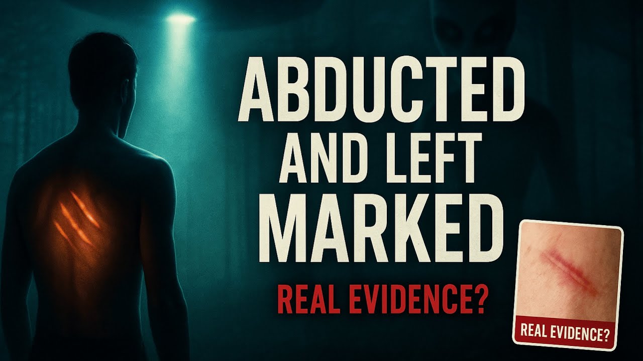 10 Alien Abduction Cases That Left Physical Evidence | Documentary for Sleep