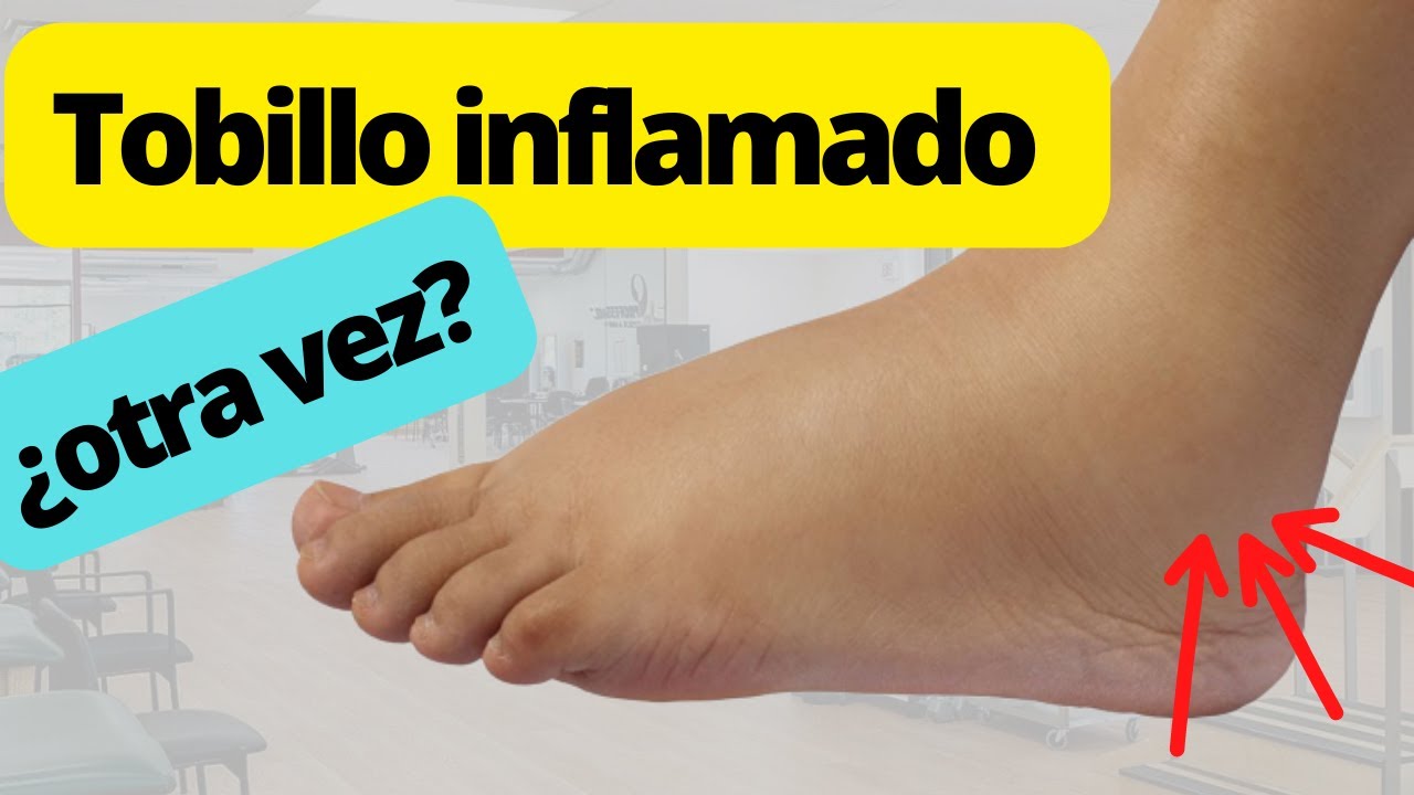 se te volvieron a INFLAMAR LOS TOBILLOS?