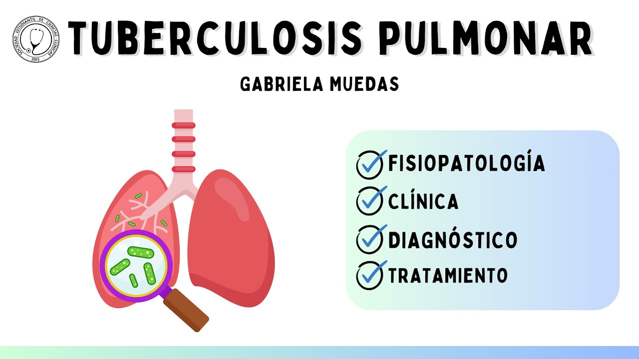 TUBERCULOSIS PULMONAR | CLÍNICA MÉDICA