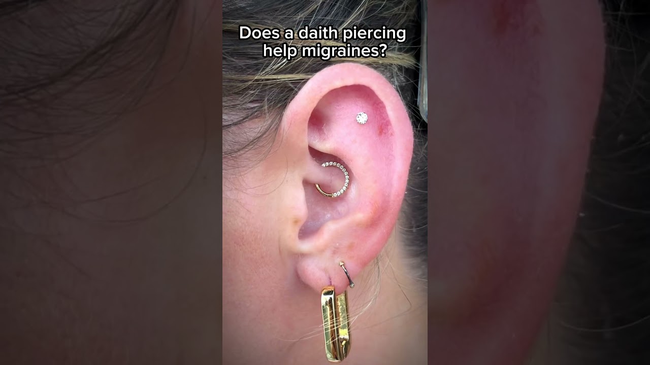 Let's talk about Daith Piercing! 🌟 Is it true that it can bring relief to migraines?