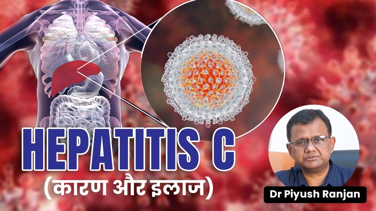 ✅Hepatitis C क्या होता है और कितना खतरनाक है?🔰Hepatitis C Causes , Prevention And Treatment In Hindi