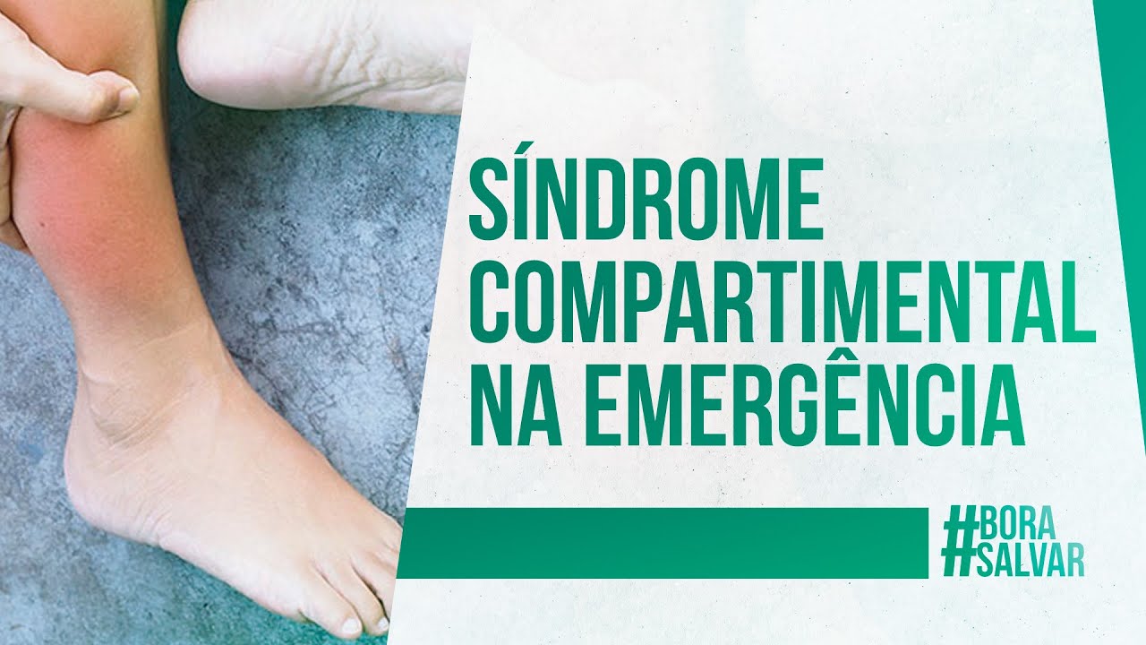 S&Iacute;NDROME COMPARTIMENTAL: Como Reconhecer?