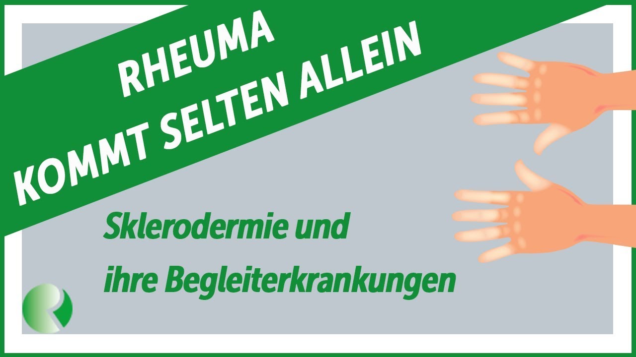 Rheuma kommt selten allein: Systemische Sklerodermie und ihre Begleiterkrankungen