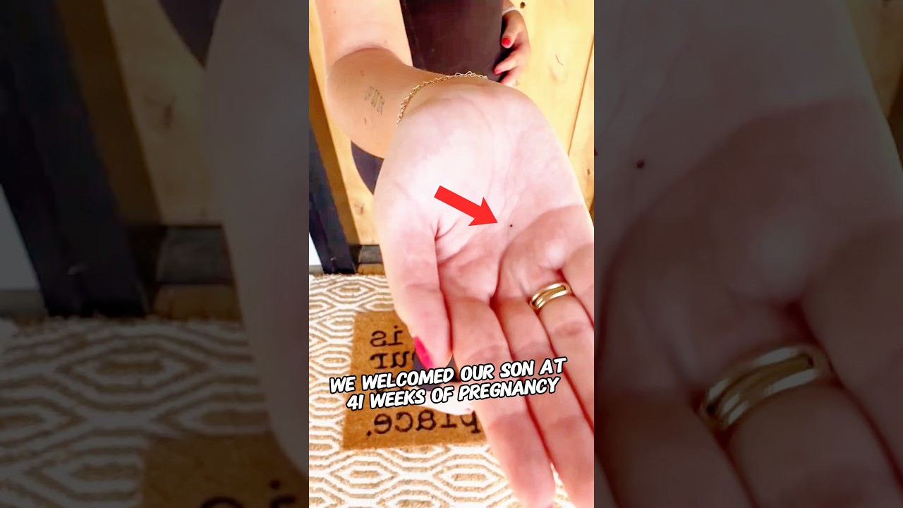 Она была на 41-й неделе беременности и родила сына. #шорты