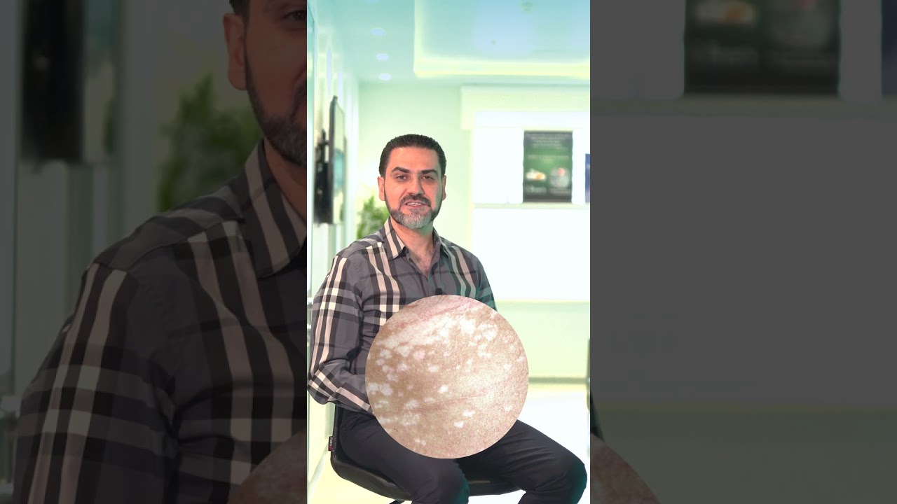 کەڕووی رەنگاوڕەنگی پێست