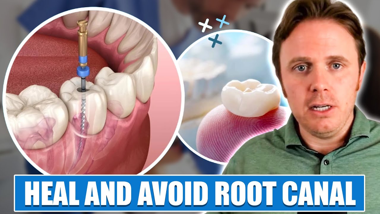 Dr. J's Cracked Tooth | How to Heal and Avoid Root Canal
