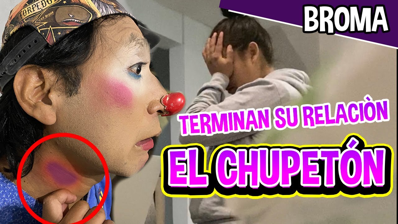 BROMA / JOSS TIENE CHUPETÓN EN EL CUELLO / TERMINA RELACIÓN CON FATIMA / LOS DESTRAMPADOS