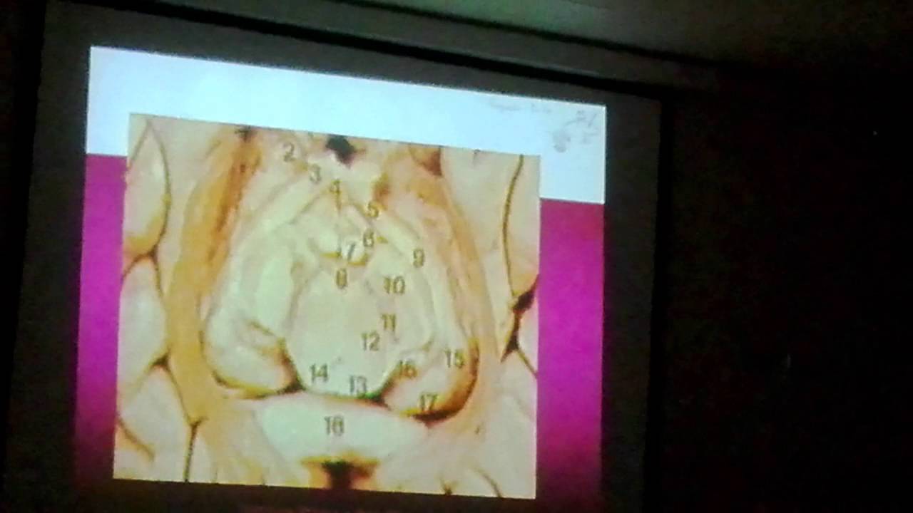 TC cerebro 1