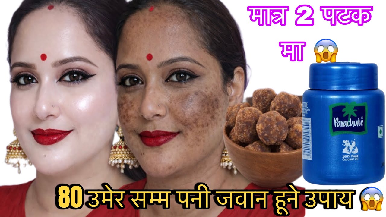 दुई थोपा लगाको मेरो अनुहार त हीरा💎 जस्तै चम्कीन थाल्यो 😱10 बर्ष पुरानो चाया पोतो दागधब्बा गायब🫢#skin