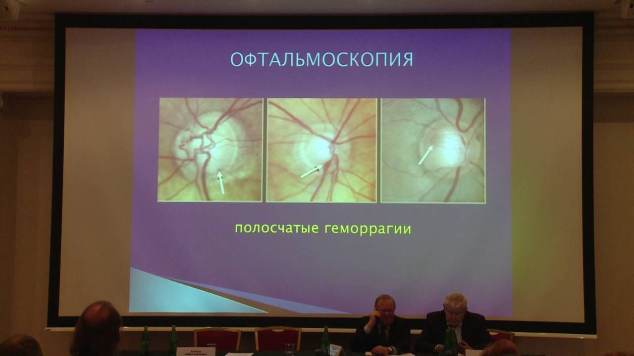 «Ключевые моменты в диагностике глаукомы»