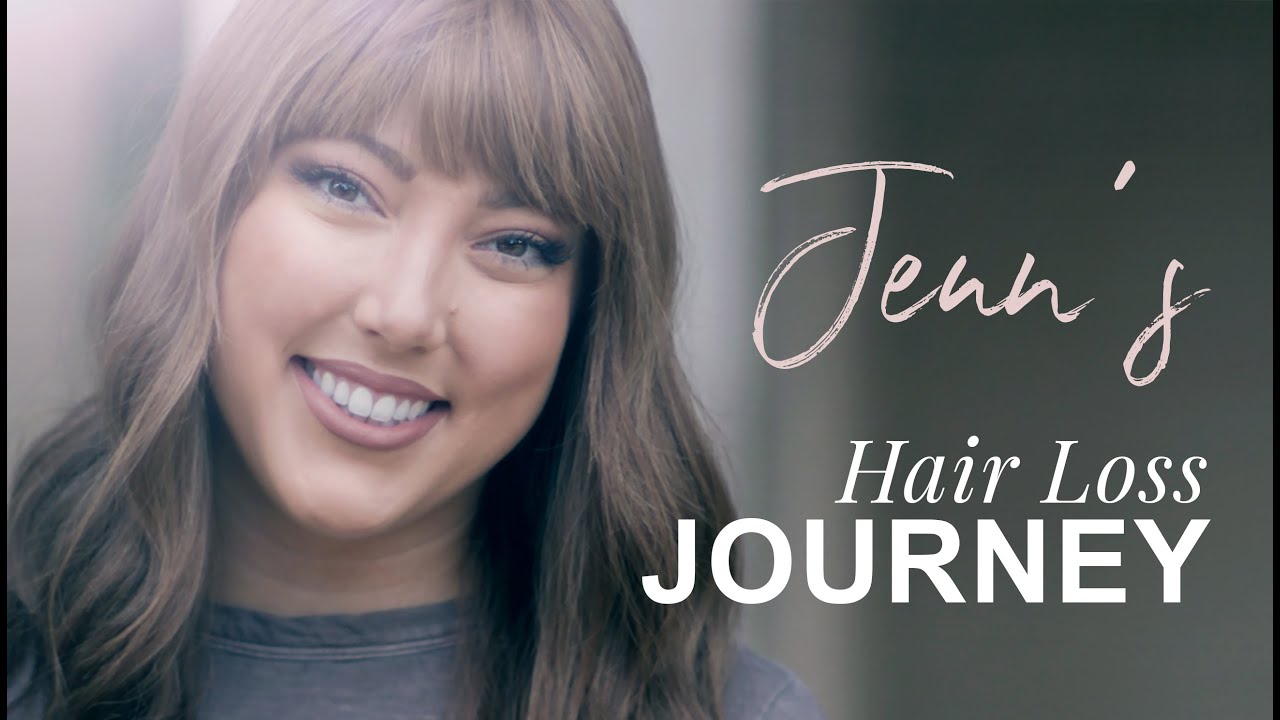Living With Androgenetic Alopecia - Jenn's Success Story | Daniel Alain