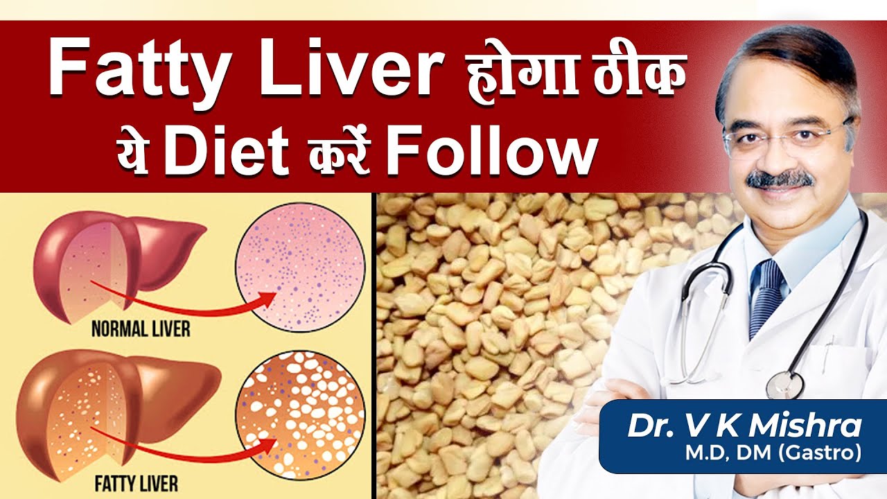 Fatty Liver होगा ठीक ये Diet करें Follow || INDIAN DIET PLAN FOR FATTY LIVER