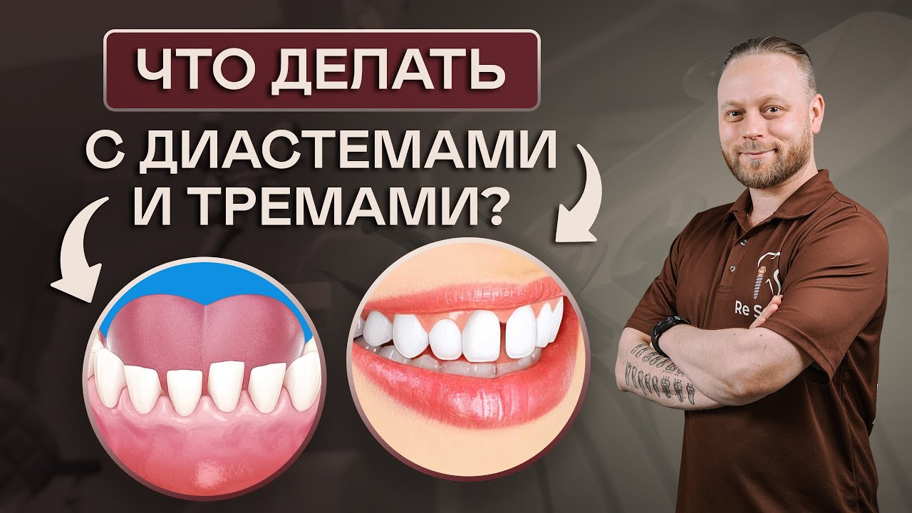 ЧТО ДЕЛАТЬ С ДИАСТЕМАМИ  И ТРЕМАМИ? Пути решения ПРОБЛЕМЫ ТРЕМОВ И ДИАСТЕМ.