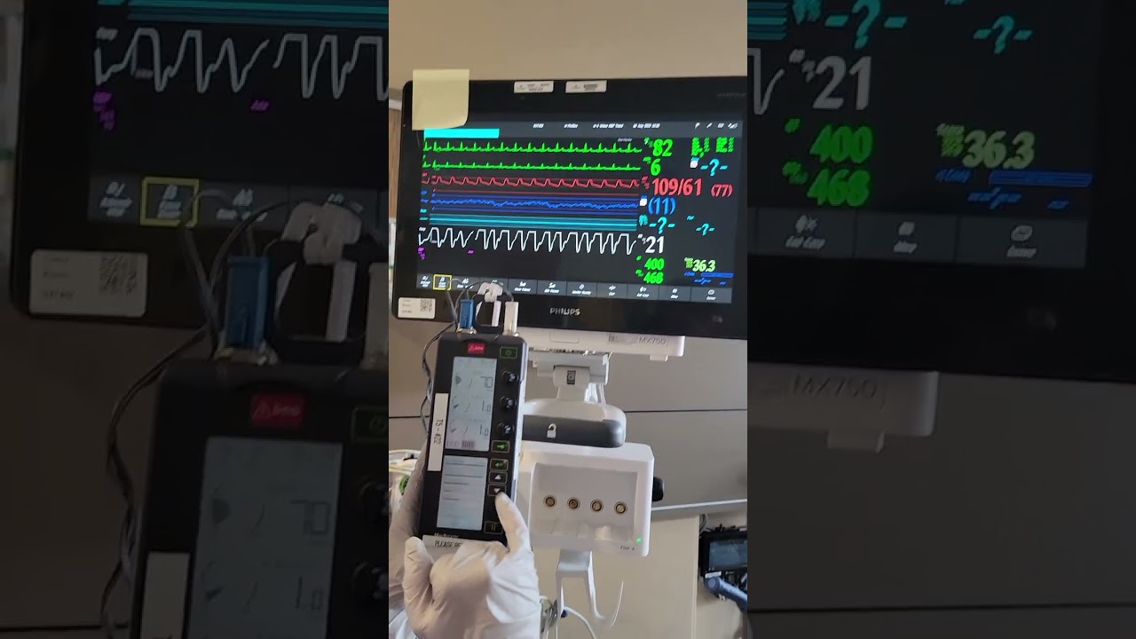 Epicardial Pacemaker checking thresholds