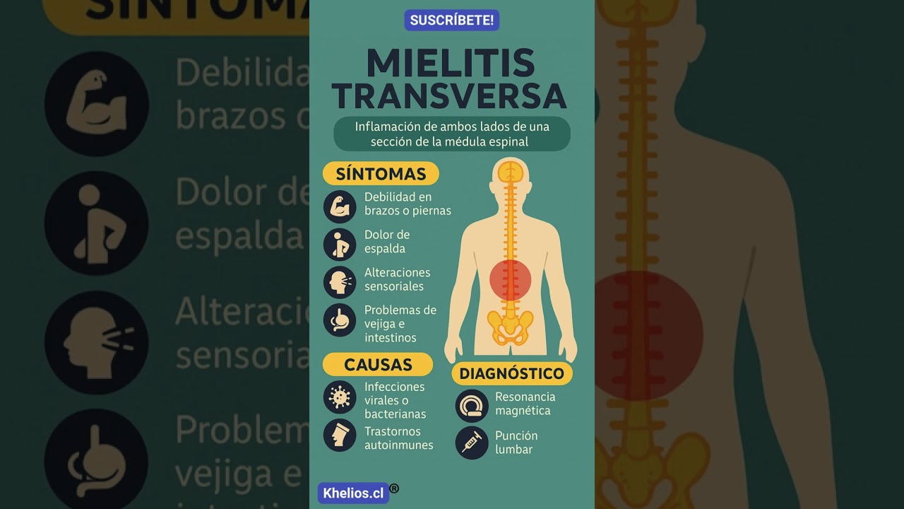 👉 Mielitis Transversa: se&ntilde;ales de alerta en tu m&eacute;dula espinal ⚡