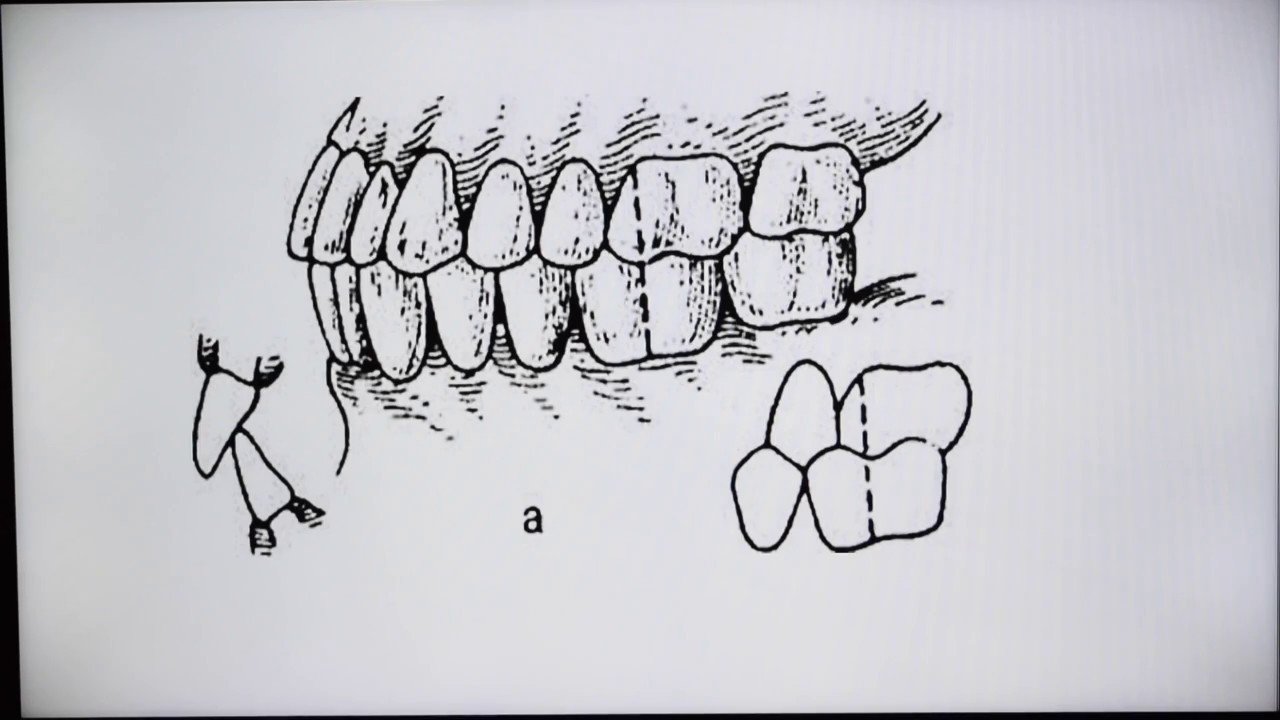 Dental Anatomy - MCQs discussion