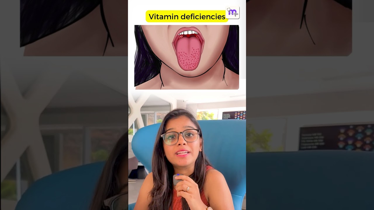 🍓5 Strawberry Signs in Medicine You Shouldn&rsquo;t Miss!