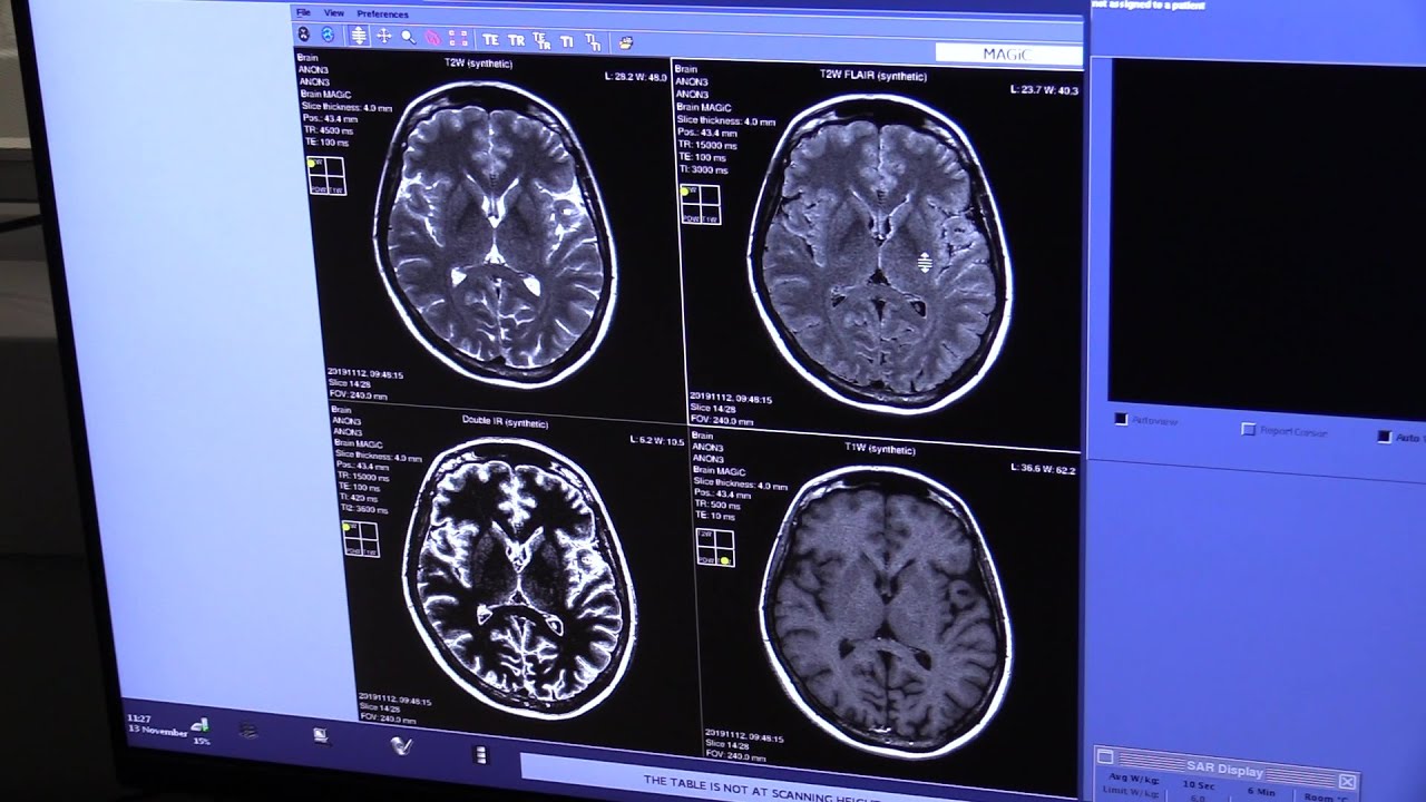 Życie z chorobą Parkinsona 10.05.2024