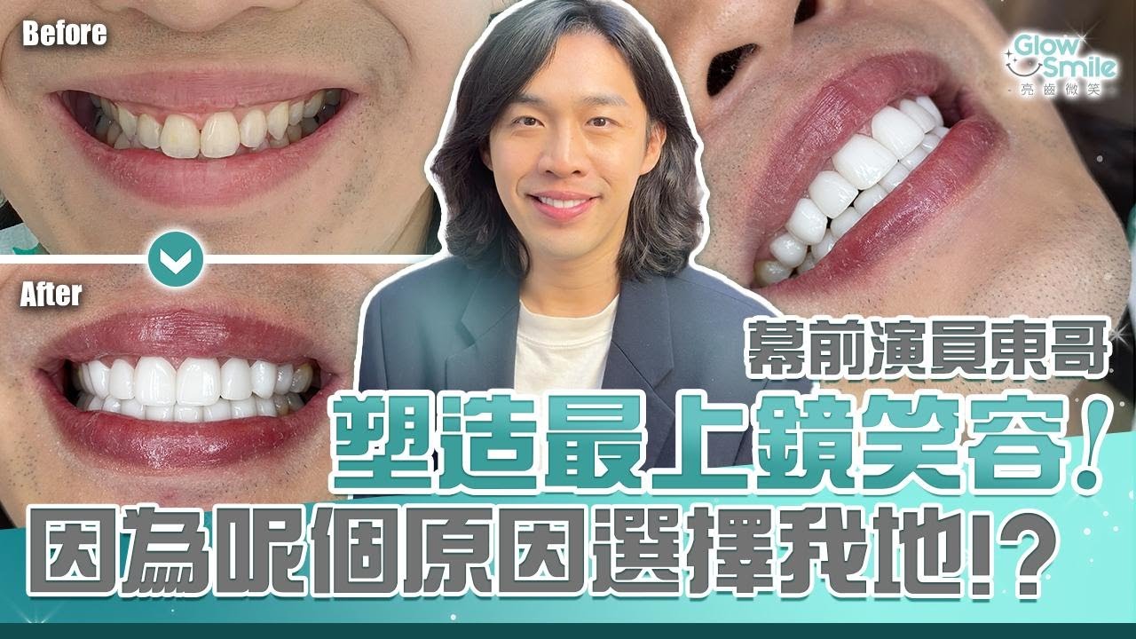 《演員張翼東 2025改變人生的重大決定》 #真人盲測 #全瓷牙貼面 #過程大公開
