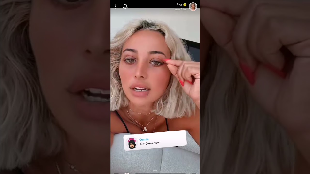 شاهدي كيف ظهرت الموديل روز بعد عملية قص جفون عينها