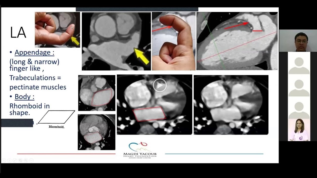Radiological society of Pakistan Webinar,,,,CT in congenital heart diseases anatomical points & TOF