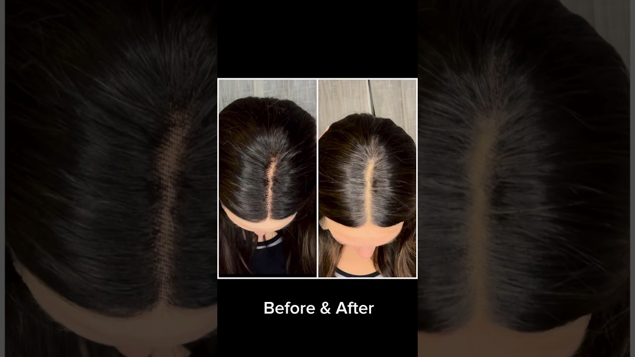 How to: conceal the knots on a lace wig #uniwigs