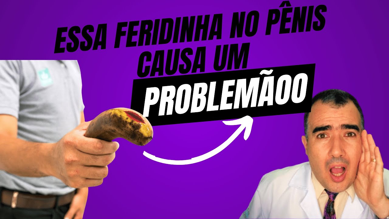 COMO você DESCOBRE se TEM UMA DST na PELE DO PÊNIS