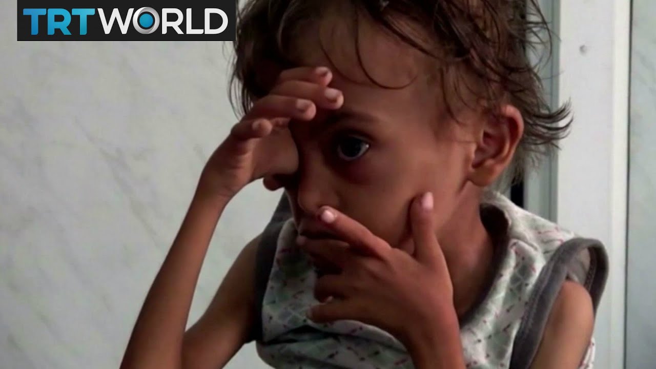 The War in Yemen: UN: Saudi blockade threatens to starve millions