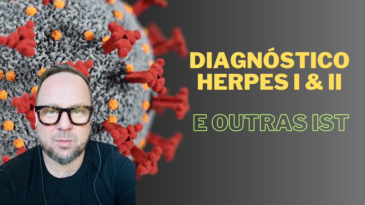 HERPES SIMPLES TIPO 1 & 2 - Renato Cassol Médico Infectologista