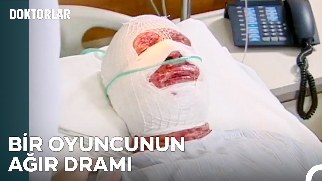 Unutulmaz Vakalar #15: Yanık Kurbanı - Doktorlar