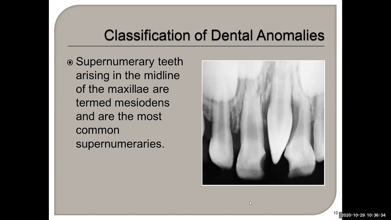 Chapter 7 Dental Anomalies