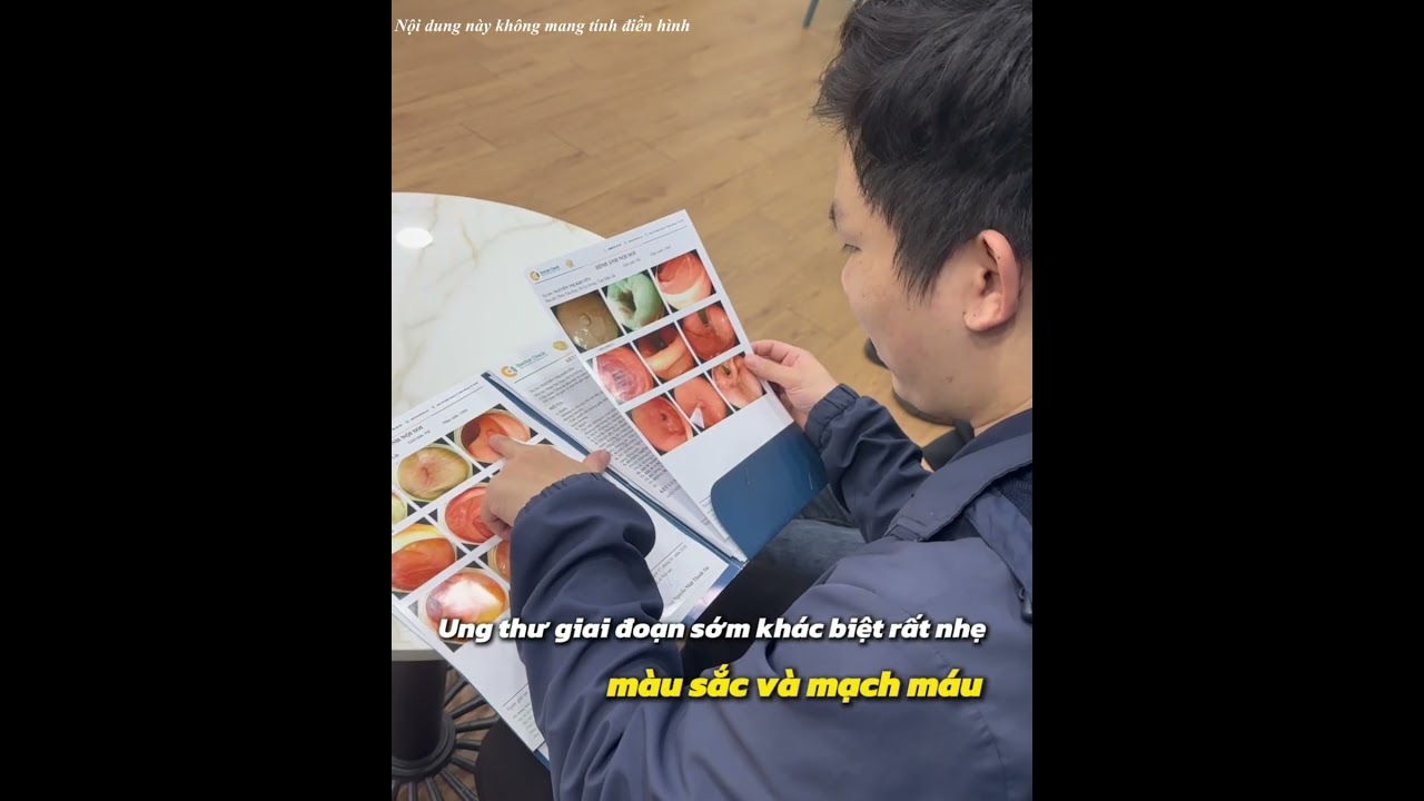 Phát hiện tổn thương dạ dày chỉ 1mm – Nhờ ánh sáng NBI “nhuộm màu” ung thư