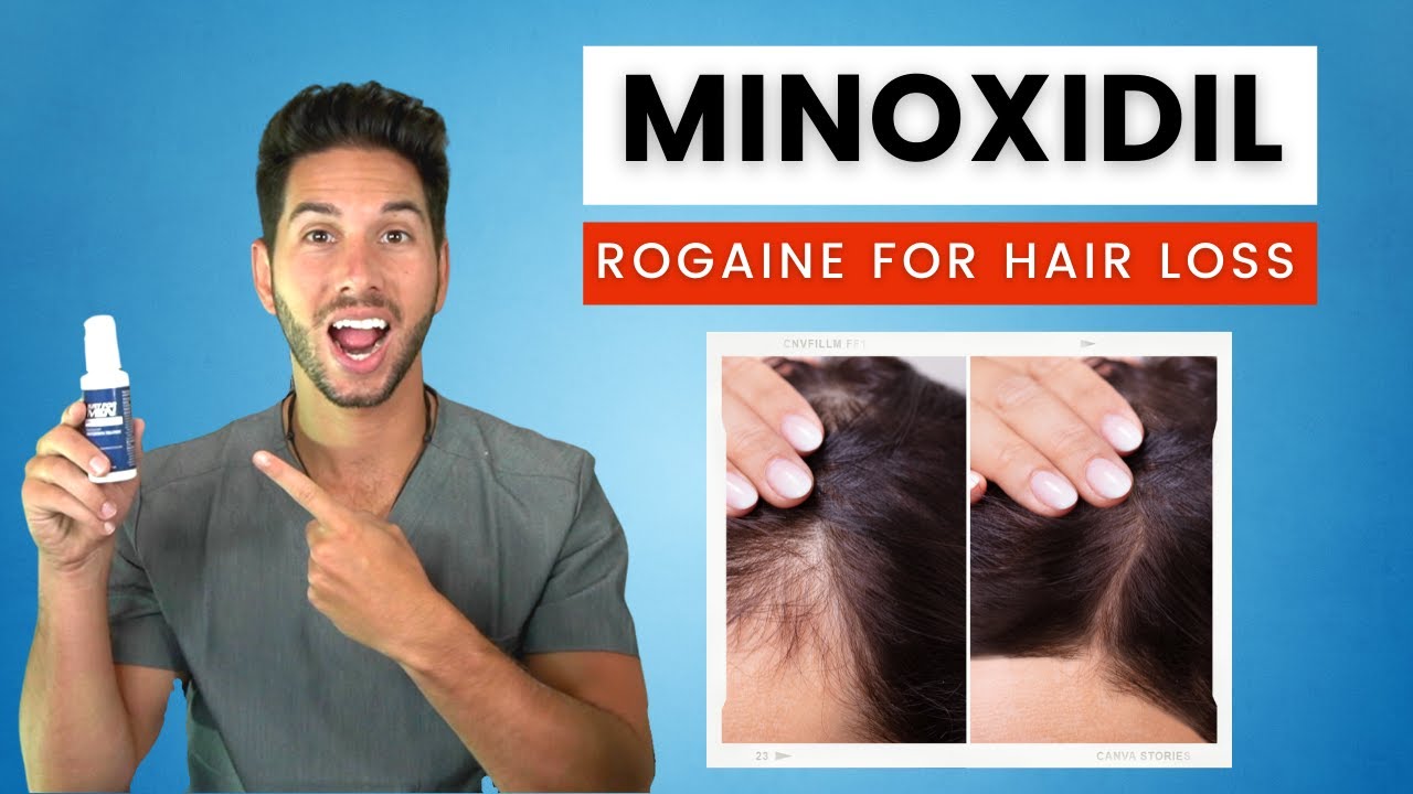 Minoxidil Hair Treatment: Side Effects, Best Practices, & Results [2021]