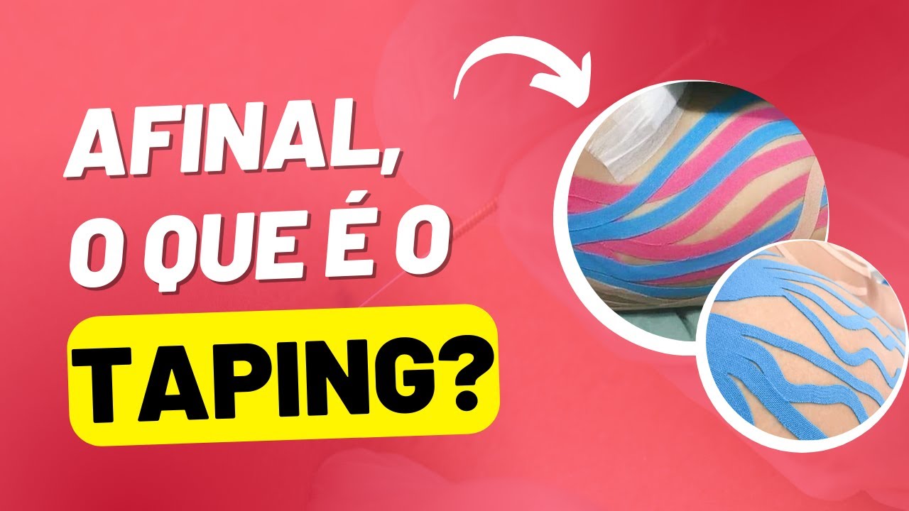 O que é o TAPING NA ESTÉTICA E PÓS OPERATÓRIO?