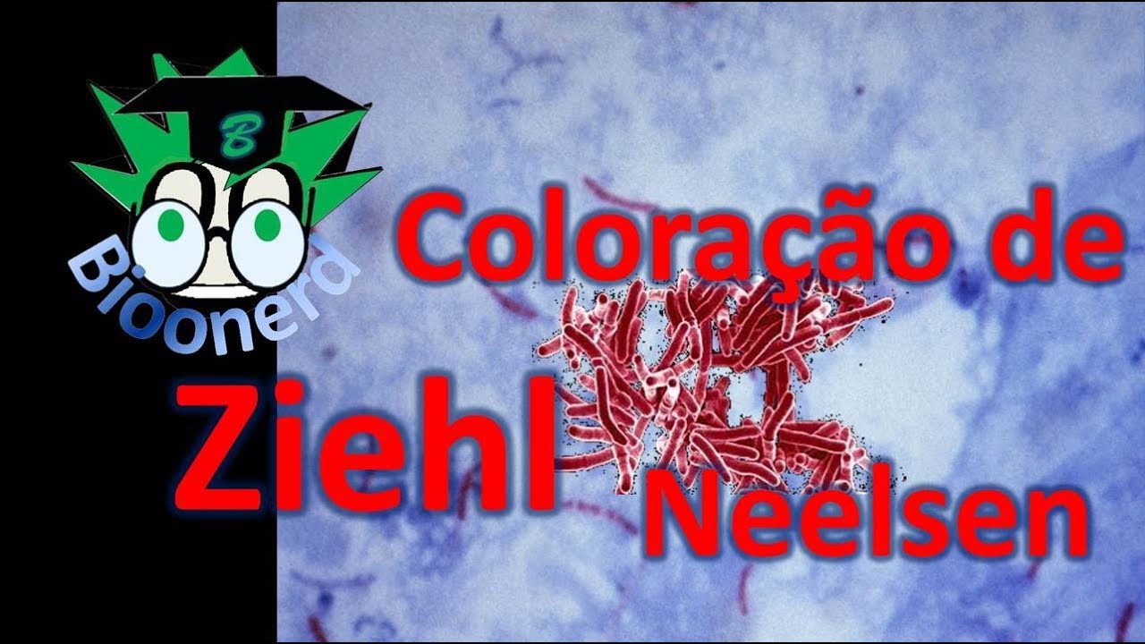 Coloração de Ziehl Neelsen-BAAR