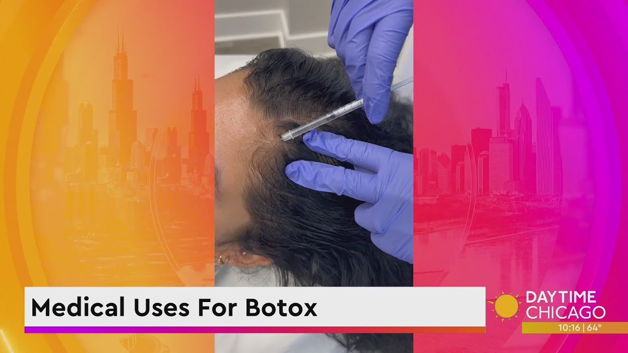 Medical Uses For Botox