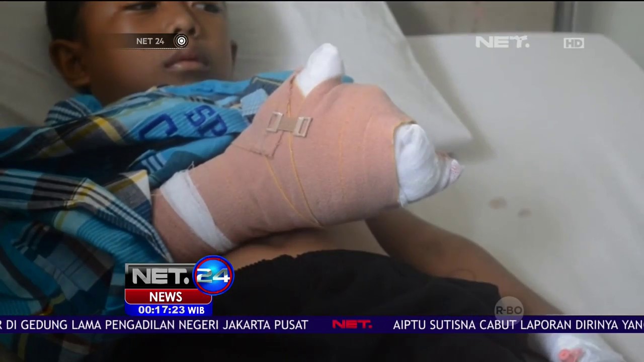 Kembang Api Meledak, Jari Telunjuk Putus – NET24