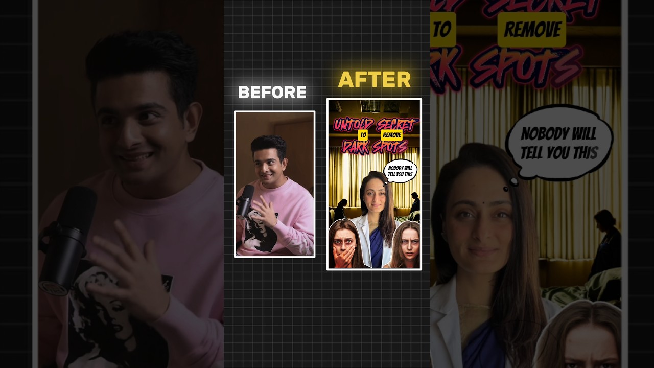 Day 21: How to Remove Dark Spots Fast 🤯 | Ranveer Allahbadia 