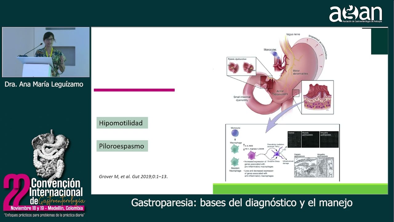 Gastroparesia, bases del diagnóstico y el manejo - Dra. Ana María Leguízamo