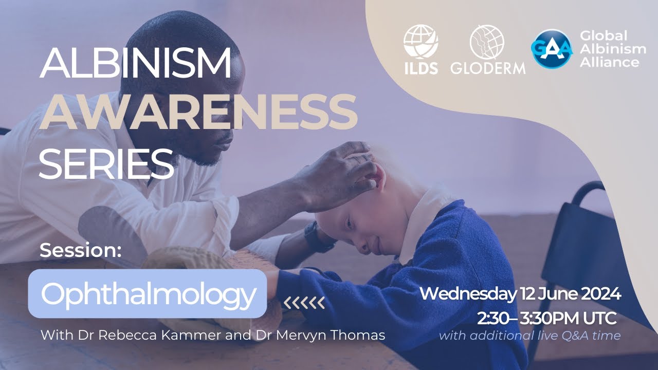 GLODERM x Global Albinism Alliance | Albinism Awareness Series | Ophthalmology