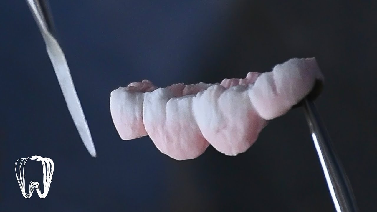 آموزش پودر گذاری اناتومی دندان porcelain bridge, dental ceramic, dental anatomy