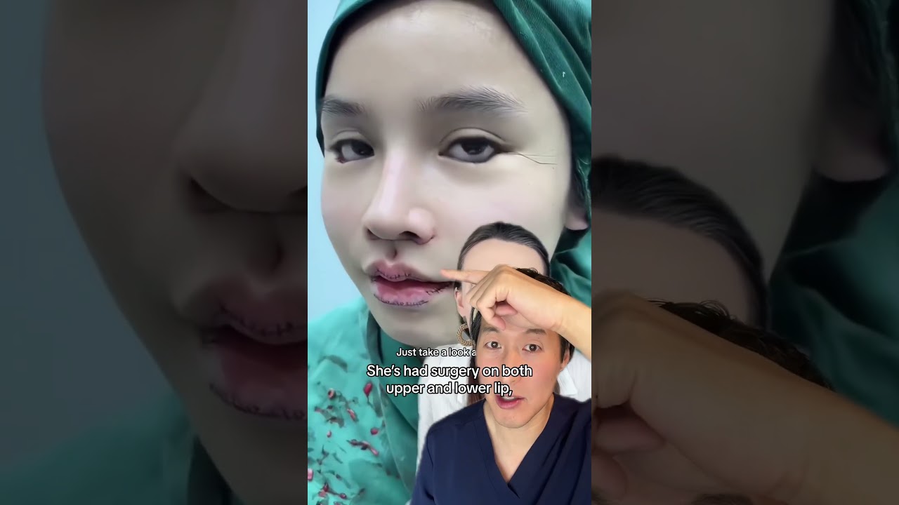 Plastic Surgery: How Much is Too Much?? #plasticsurgery
