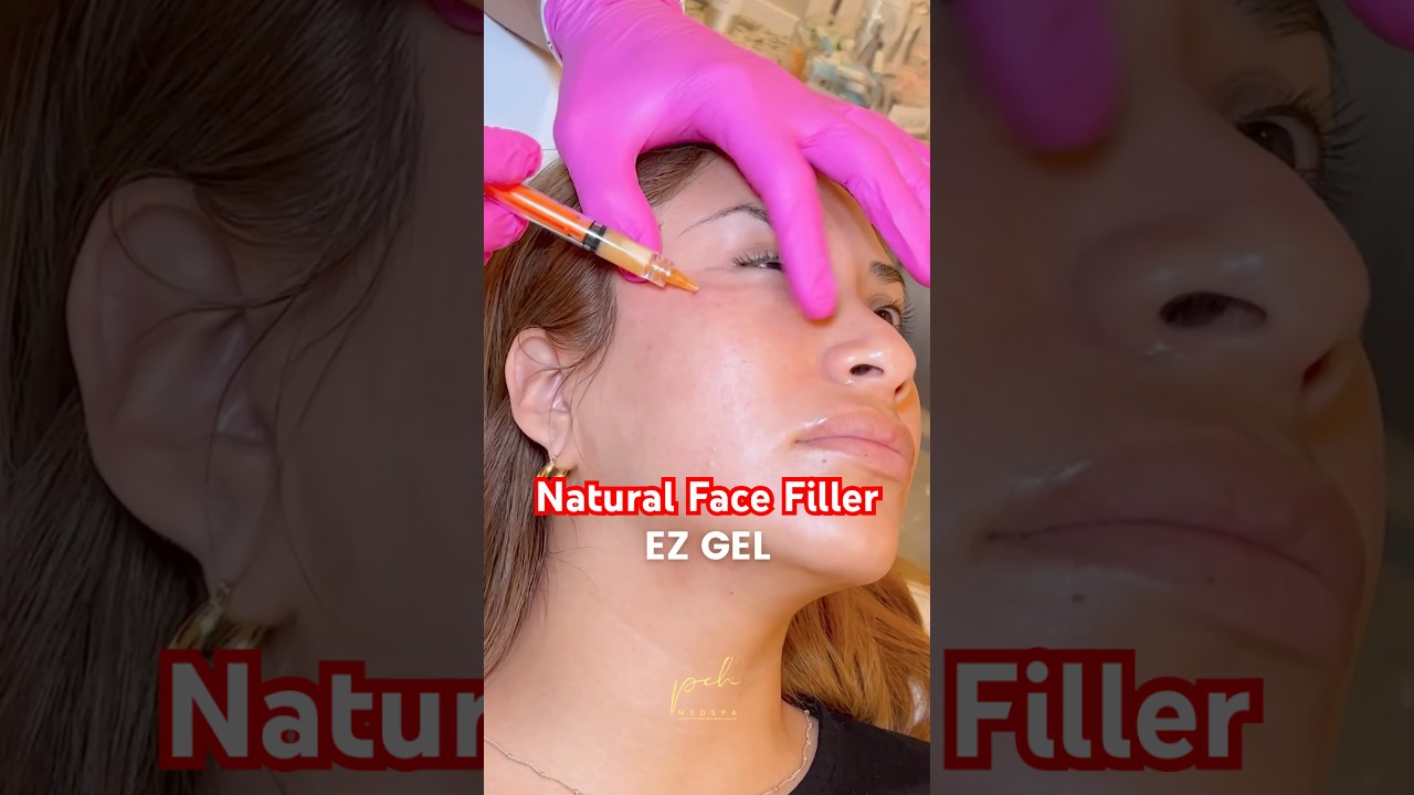 EZ GEL PRF: натуральный наполнитель из вашей крови? | Результаты исследований в Ньюпорт-Бич