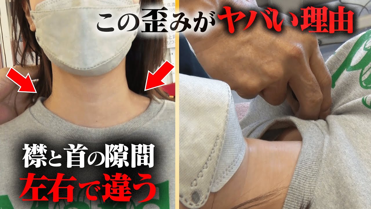 Tシャツの隙間から分かる体の歪みの正体。骨盤・肩甲骨全部アウトな美人の悶絶。 〜悶絶整体〜