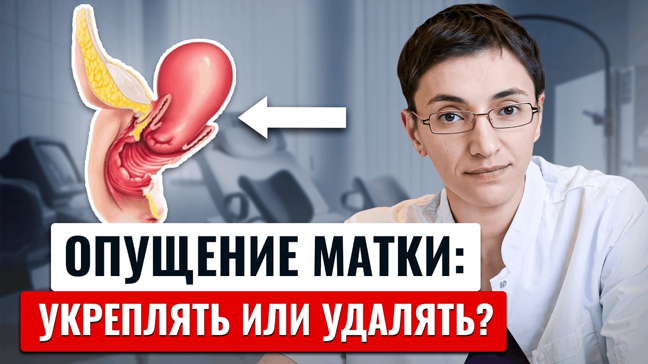 Выпадение матки: выбор эффективного и безопасного метода фиксации